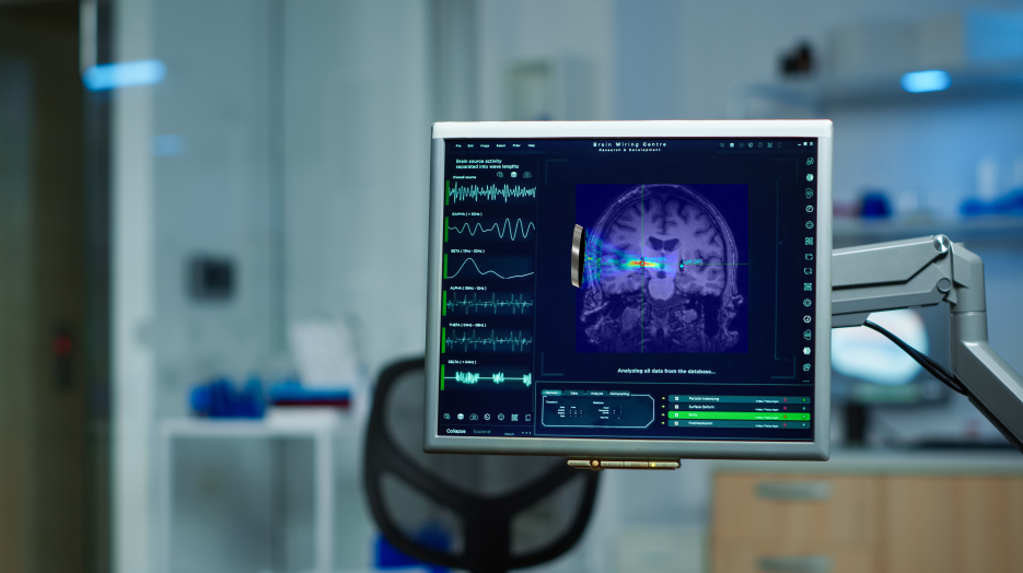 Brain being stimulated by transducer shown on screen